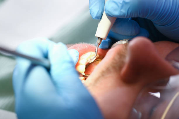 Best Knocked-Out Tooth Emergency  in Jessup, MD