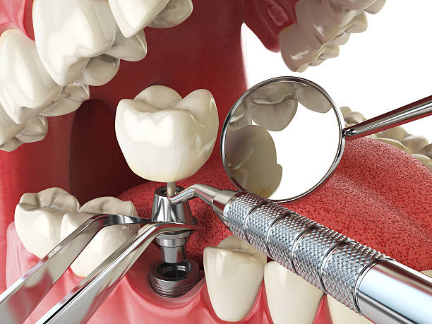Best Dental Emergency Near Me  in Jessup, MD